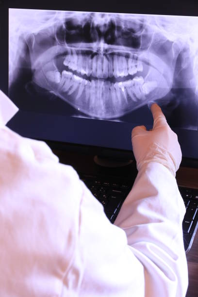 Best Emergency Treatment for Toothache in South Laurel, MD