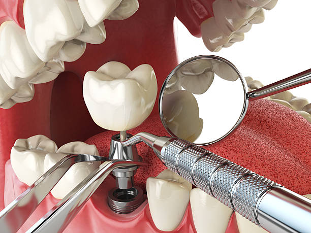Best Walk-In Emergency Dentist in South Laurel, MD