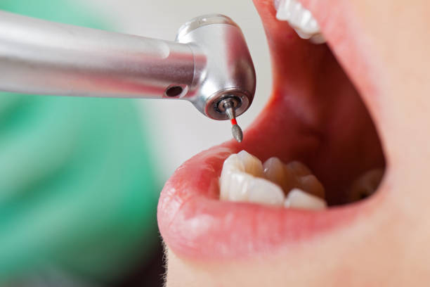 Best Emergency Treatment for Toothache in South Laurel, MD